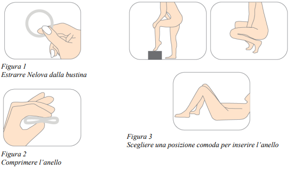 Anello vaginale hot sale e rapporti